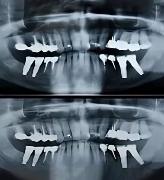 Panorex in Toms River, NJ - North Dover Dental