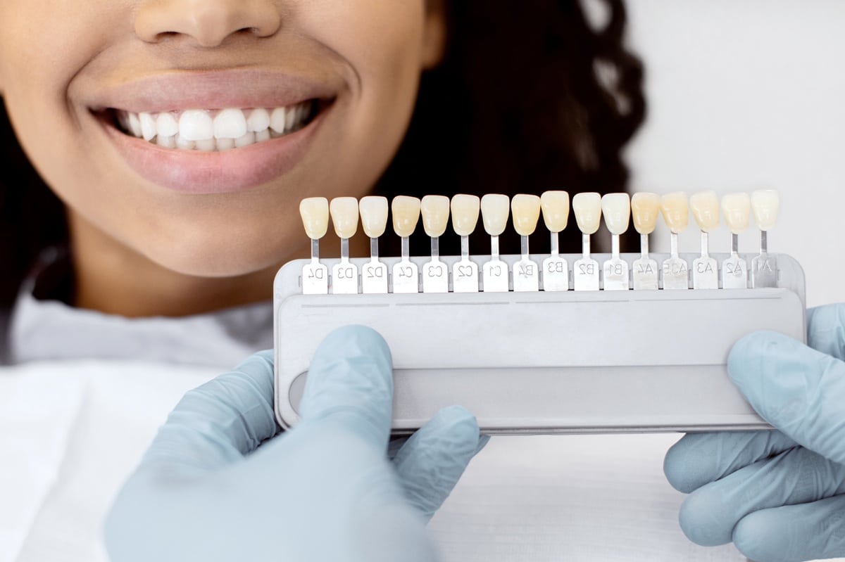 what happens to teeth under veneers