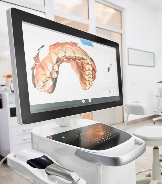 Comfortable Digital Impressions Without Traditional Putty Materials